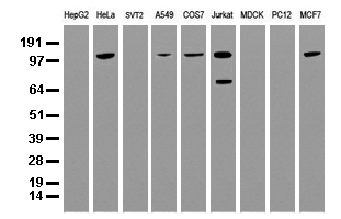 UBE2D4 Antibody