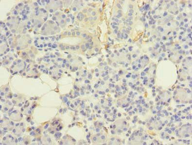 UBE2G2 Antibody