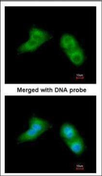 UBE2G2 antibody [N1C3]