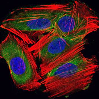 UBE2I Antibody