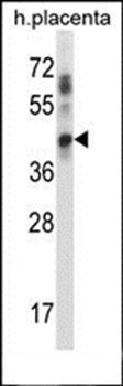 UBE2J1 antibody