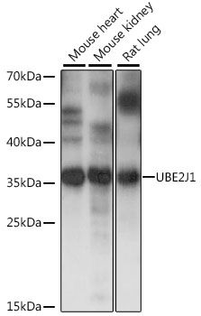 UBE2J1 antibody