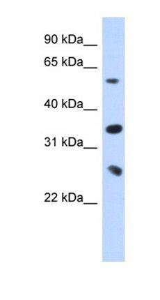UBE2K antibody