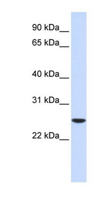 UBE2K antibody