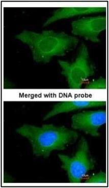 ubiquitin conjugating enzyme E2 L3 Antibody