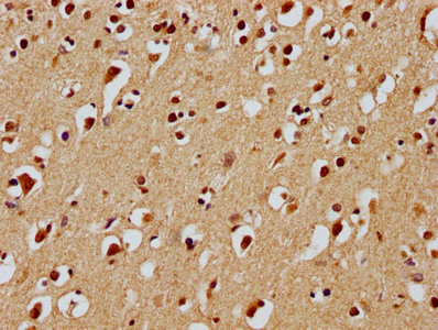 UBE2M Antibody
