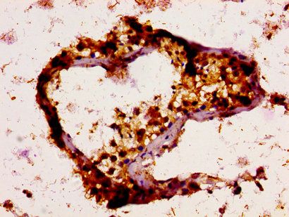 UBE2N Antibody