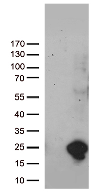 UBE2NL antibody