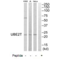 UBE2T antibody