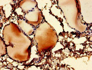 UBE2V1 Antibody