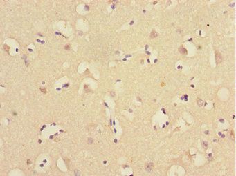 UBE2Z Antibody