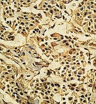 UBE3A Rabbit Polyclonal Antibody
