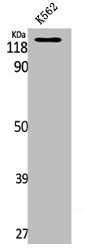 UBE3C antibody