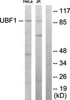 UBF1 antibody