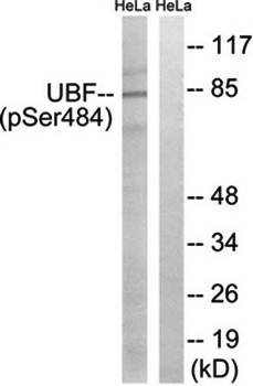 UBF (phospho-Ser484) antibody