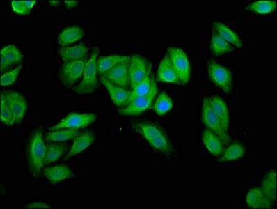 UBIAD1 Antibody