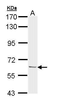 Ubiquilin 1 Rabbit Polyclonal Antibody