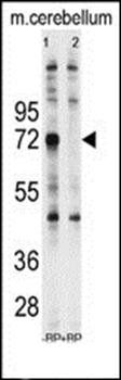 Ubiquilin1 antibody