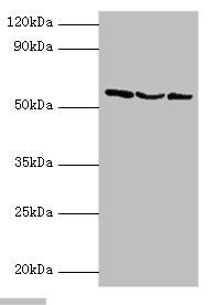 Ubiquitin carboxyl-terminal hydrolase 14 antibody