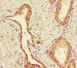 Ubiquitin-conjugating enzyme E2 Q2 antibody