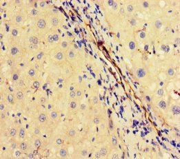 Ubiquitin thioesterase OTUB1 antibody