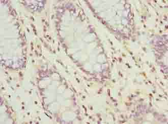 UBL3 Antibody