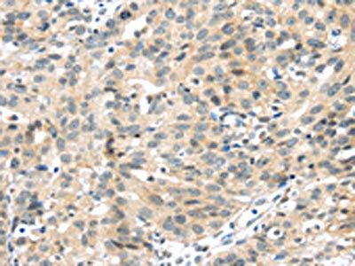 UBL3 Antibody
