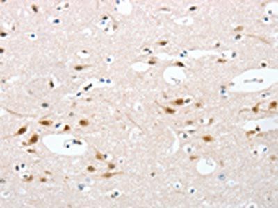 UBQLN1 Antibody