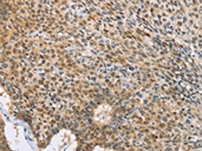 UBQLN1 Antibody