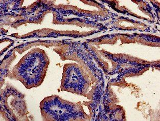 UBQLN2 Antibody