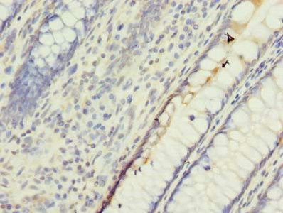 UBQLNL Antibody