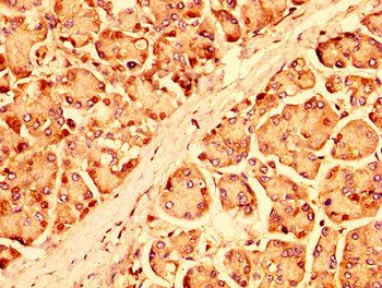 UBR1 Antibody