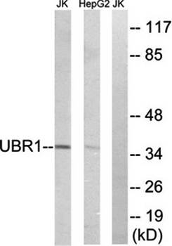 UBR1 Antibody