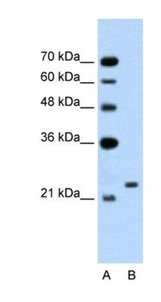 UBR7 antibody