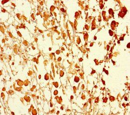 UBXN2B Antibody