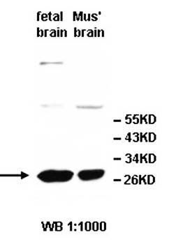 UCHL1 antibody