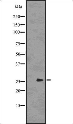 UCHL3 antibody