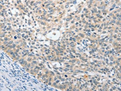 UCHL5 Antibody