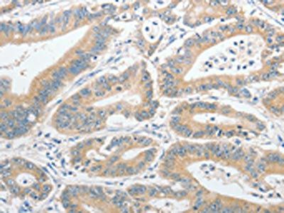 UCHL5 Antibody