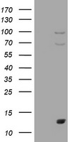 UCHL5IP (HAUS7) antibody