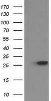 UCK (UCK1) antibody