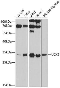 UCK2 antibody
