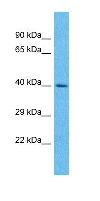 UCKL1 antibody