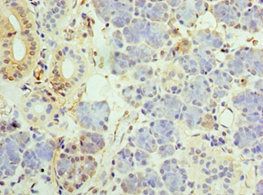 UCP1 Antibody
