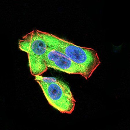 UCP2 Antibody