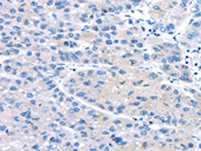 UCP2 Antibody