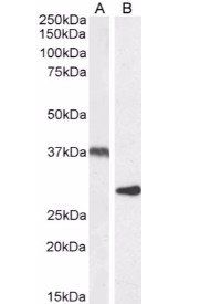 Goat anti-Uncoupling protein 2 / UCP2 Antibody