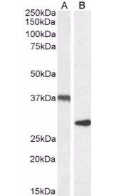 UCP2 antibody