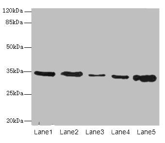 UCP3 Antibody