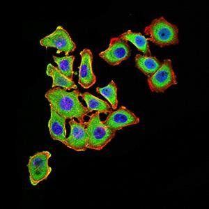 UCP3 Antibody